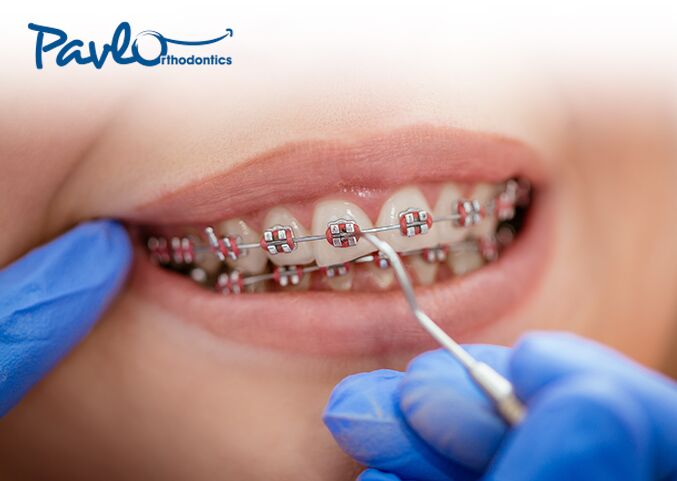 Leesburg Orthodontist